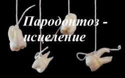 Методика избавления от пародонтоза, пародонтита, кариеса