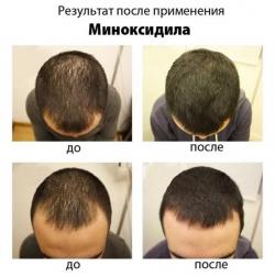 Косметолог в салоне красоты