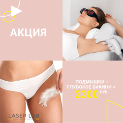 Лазерная эпиляция диодная